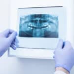 MARCH26 When Dental IT Network Support Fails The Hidden Chain Reaction Inside a Dental Office